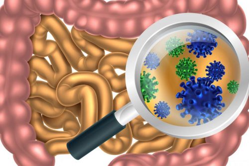 A new approach to IBS treatment: addressing small intestine bacterial overgrowth (SIBO)
