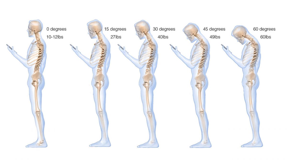 Are Smartphones Ruining Your Posture? | IMI - Integrated Medicine Institute